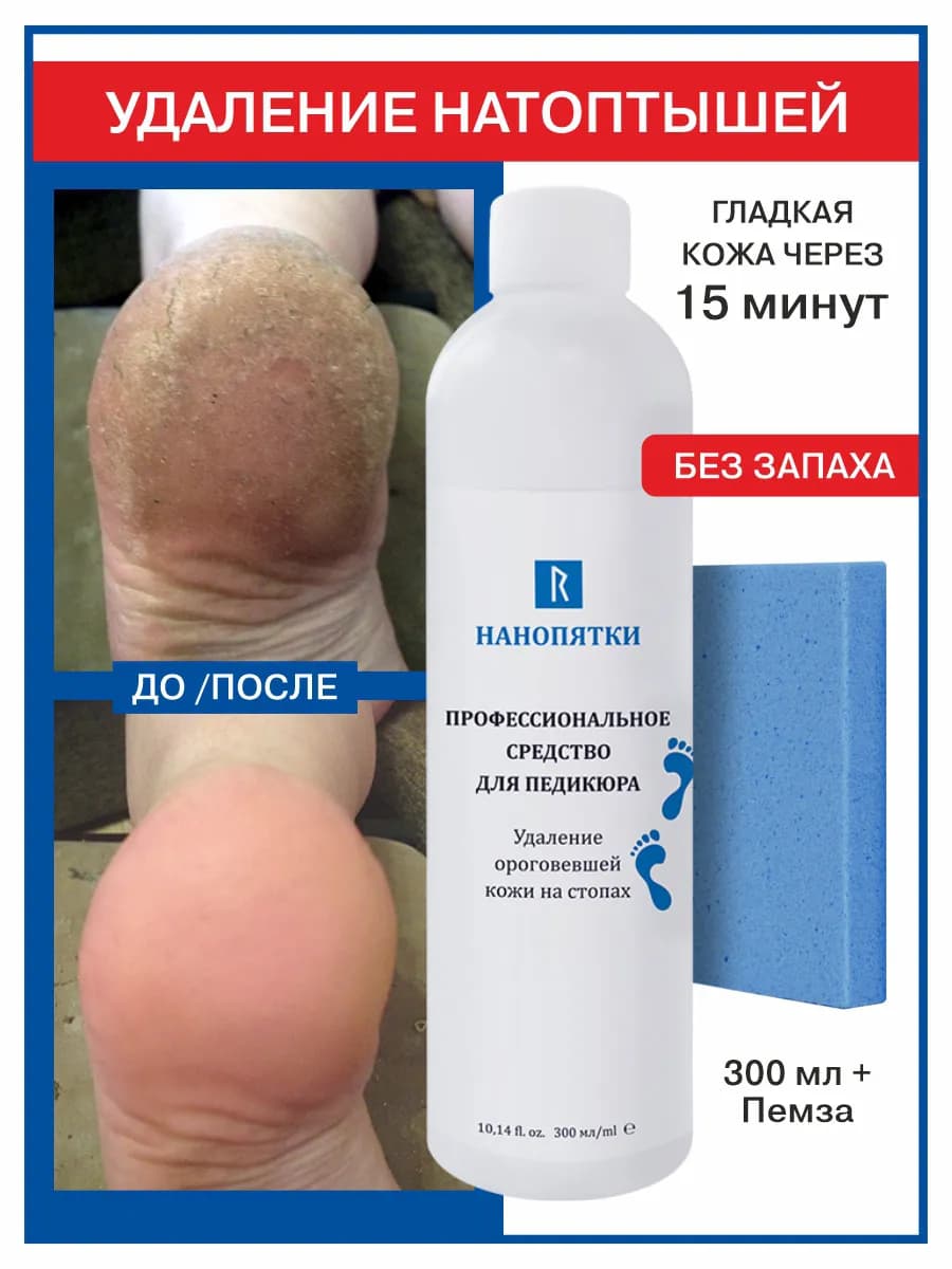 Средство для педикюра, 300 мл + пемза для гладких ровных пят…