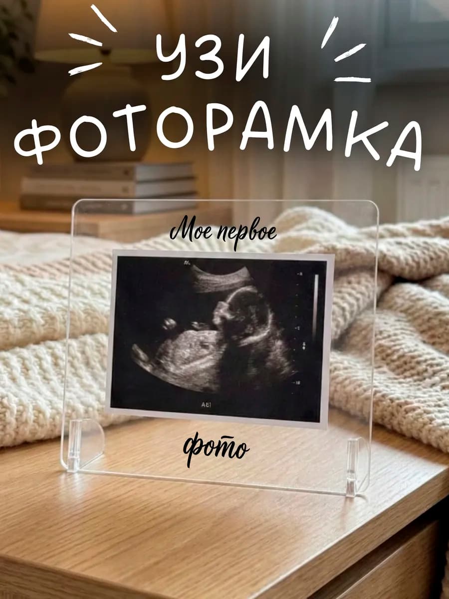 Фоторамка для снимка узи беременности в подарок